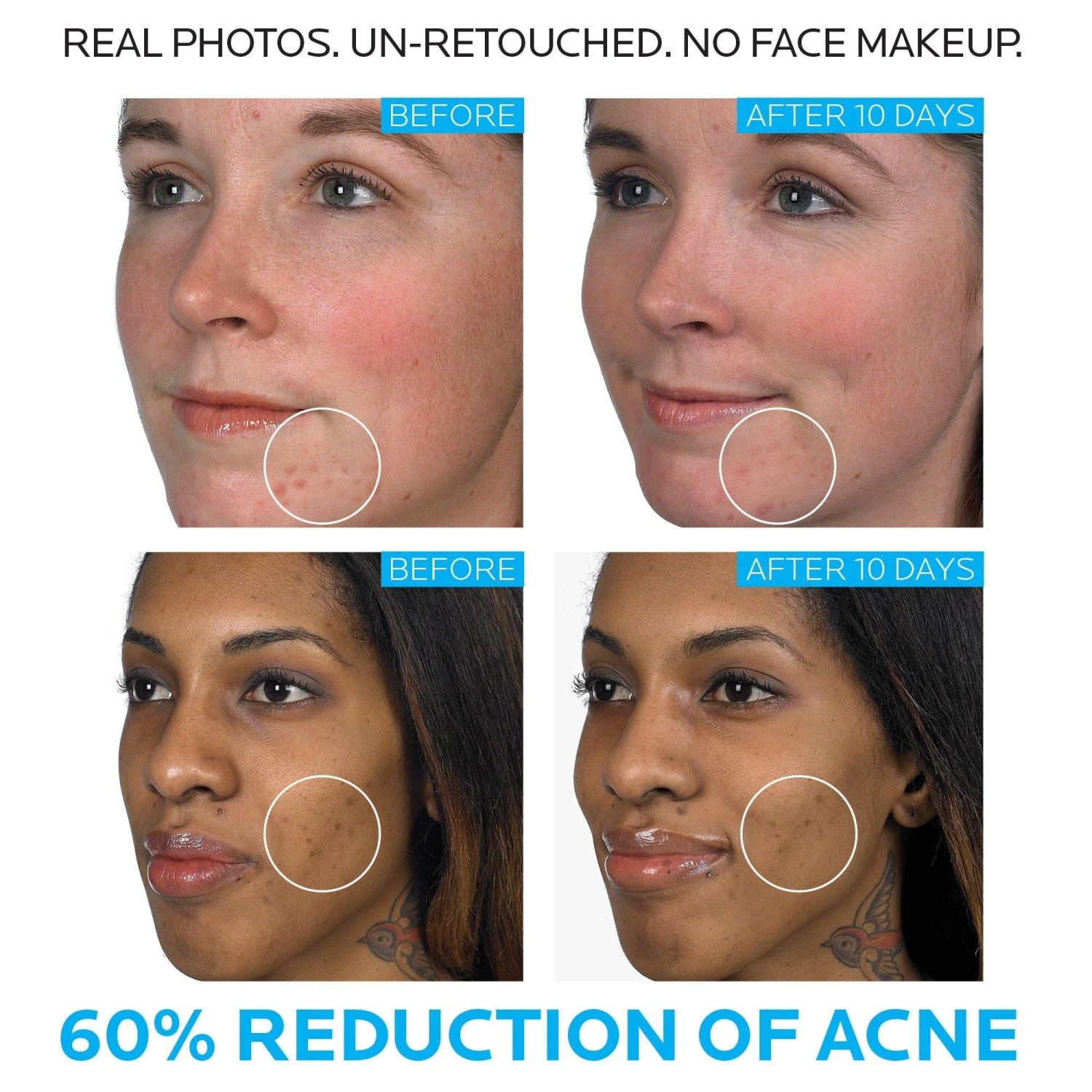 LA ROCHE-POSAY EFFACLAR DUO DUAL ACNE TREATMENT WITH BENZOYL PEROXIDE 3 LA ROCHE-POSAY EFFACLAR DUO DUAL ACNE TREATMENT WITH BENZOYL PEROXIDE - Image 3