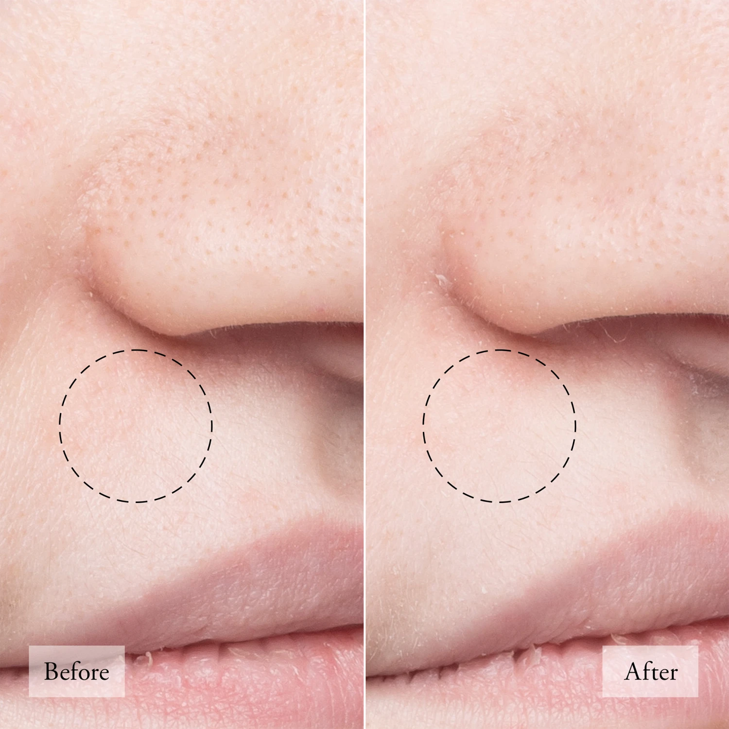 Philosophy PURITY MADE SIMPLE PORE EXTRACTOR EXFOLIATING CLAY MASK 2 Philosophy PURITY MADE SIMPLE PORE EXTRACTOR EXFOLIATING CLAY MASK - Image 2