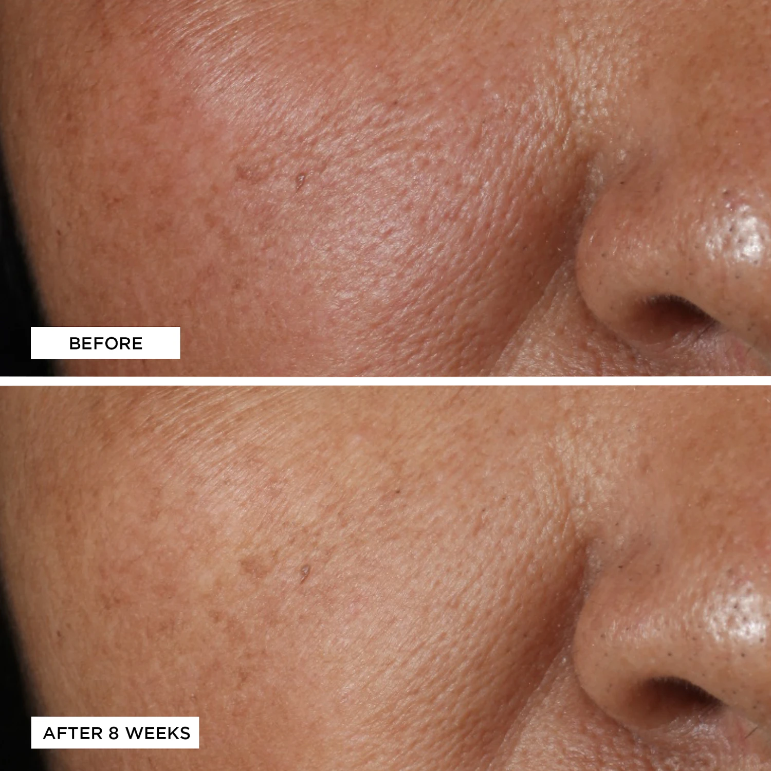 Perricone MD VITAMIN C ESTER BRIGHTENING AMINE FACE LIFT 2 Perricone MD VITAMIN C ESTER BRIGHTENING AMINE FACE LIFT - Image 2