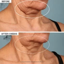 TL ADVANCED TIGHTENING NECK CREAM PLUS -Cosmetics Store 2533950cm alt07