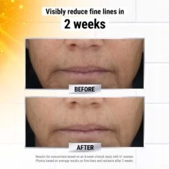 POWERFUL STRENGTH LINE REDUCING CONCENTRATE 11 POWERFUL STRENGTH LINE REDUCING CONCENTRATE -Cosmetics Store 2536636cm alt04