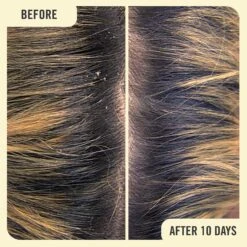 First Aid Beauty ANTI-DANDRUFF SCALP SERUM WITH 2% SALICYLIC ACID -Cosmetics Store 2582021cm alt04