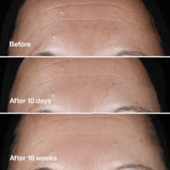 CLINIQUE SMART CLINICAL REPAIR WRINKLE CORRECTING SERUM -Cosmetics Store 2582926cm alt02