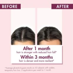 Klorane STRENGTHENING SERUM WITH QUININE AND EDELWEISS -Cosmetics Store 2586835cm alt04