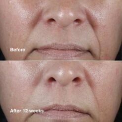 CLINIQUE SMART CLINICAL REPAIR WRINKLE CORRECTING RICH FACE CREAM 11 CLINIQUE SMART CLINICAL REPAIR WRINKLE CORRECTING RICH FACE CREAM -Cosmetics Store 2598028cm alt03