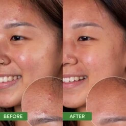 OIL CONTROL CLEARING FACE MASK 15 OIL CONTROL CLEARING FACE MASK -Cosmetics Store 2601989 alt07