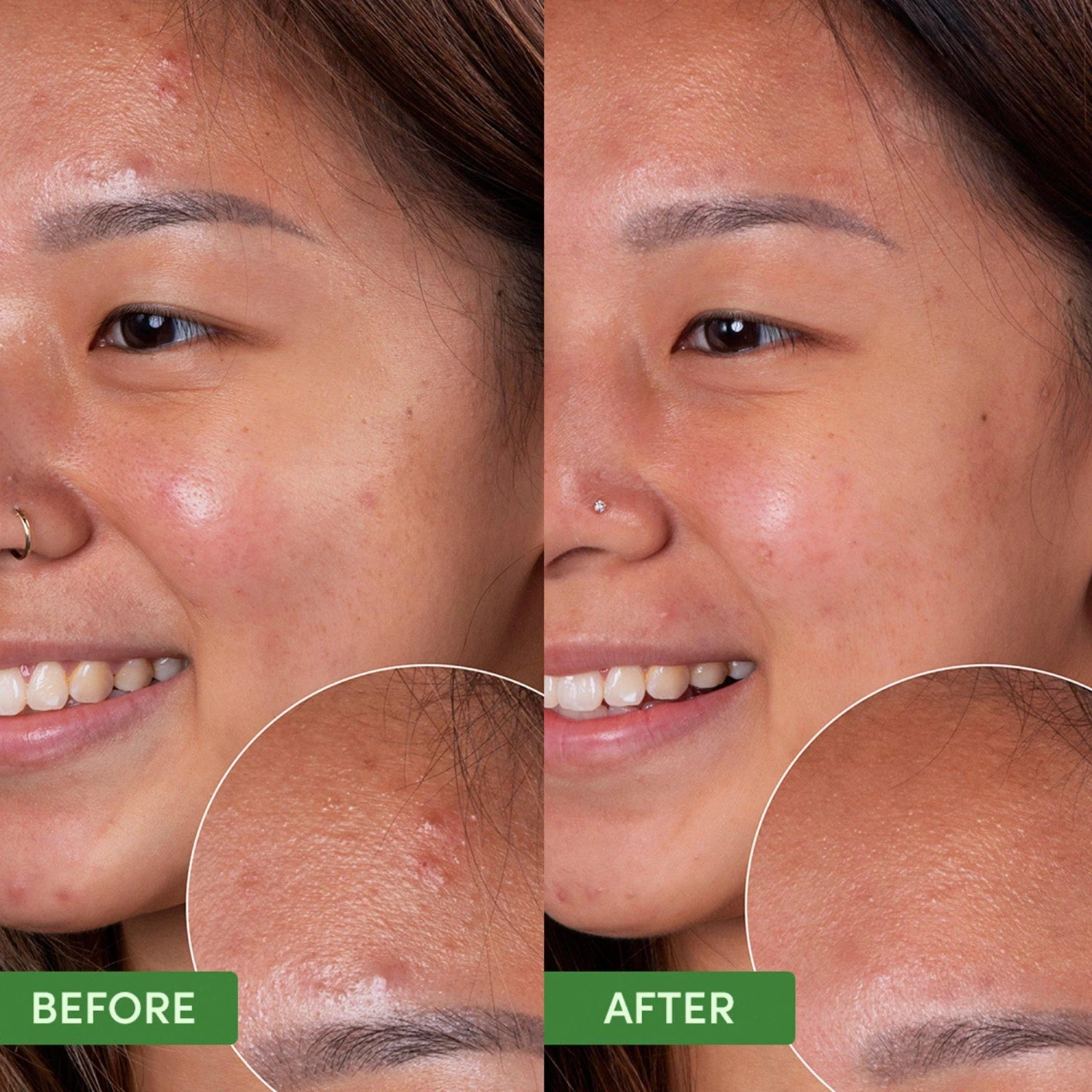 OIL CONTROL CLEARING FACE MASK 8 OIL CONTROL CLEARING FACE MASK - Image 8