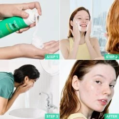 CLEAN ZIT AWAY ACNE FOAM CLEANSER 1.5% SALICYLIC ACID -Cosmetics Store 2605284 alt05